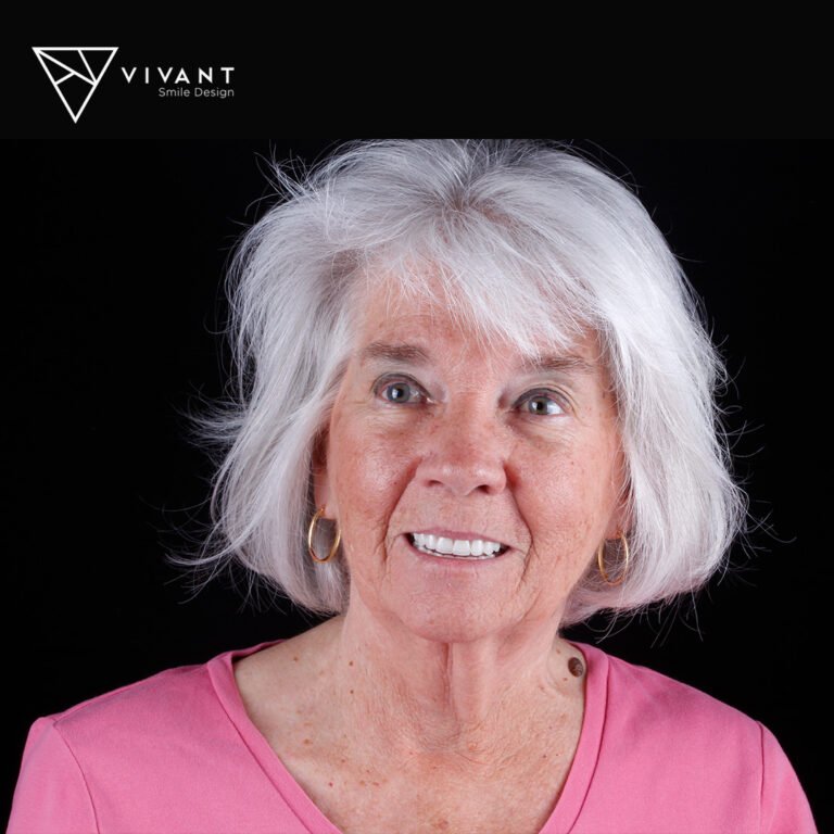 vivantsmiledesingIMPLANTES-SNAP-ON1-768x768